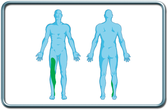 חסם עצבי פמורלי- femoral nerve block