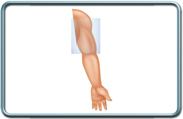 ניתוחי הזרוע- Arm surgery
