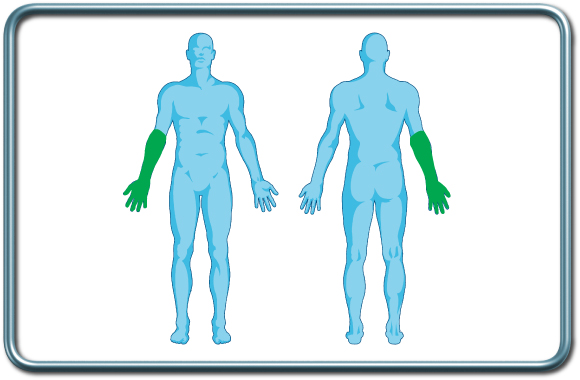 חסם עצבי תת בריחי- infraclaviular nerve block