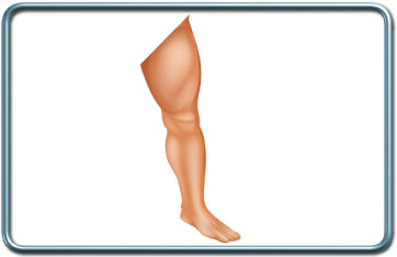 ניתוחי הגפה התחתונה- Lower limb surgery