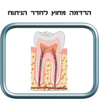 הרדמה מחוץ לחדר הניתוח