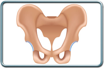 ניתוחים אורטופדים של האגן- Pelvic surgery