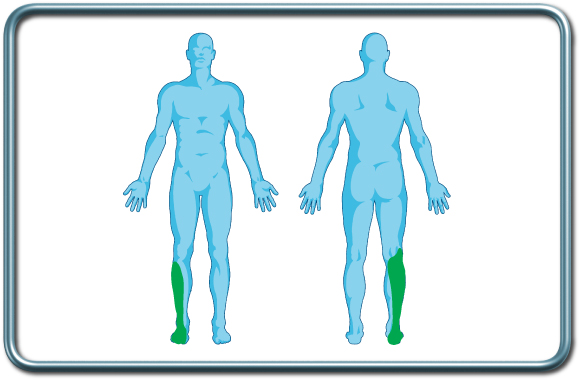 חסם עצבי סכיאטי- sciatic nerve block