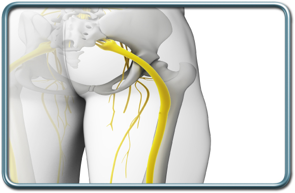 העצב הסכיאטי- sciatic nerve