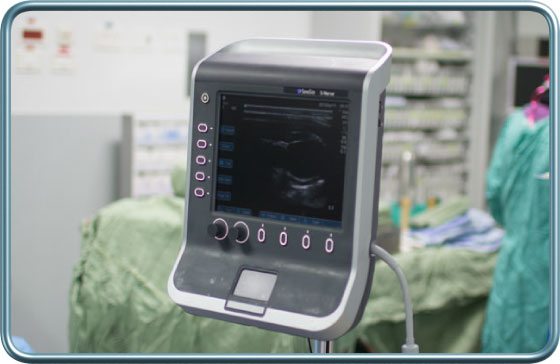 מכשיר אולטראסאונד- ultrasound device