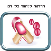 הרדמה לניתוחי כלי דם